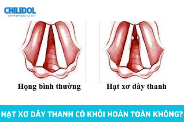 Hạt xơ dây thanh có khỏi hoàn toàn không?