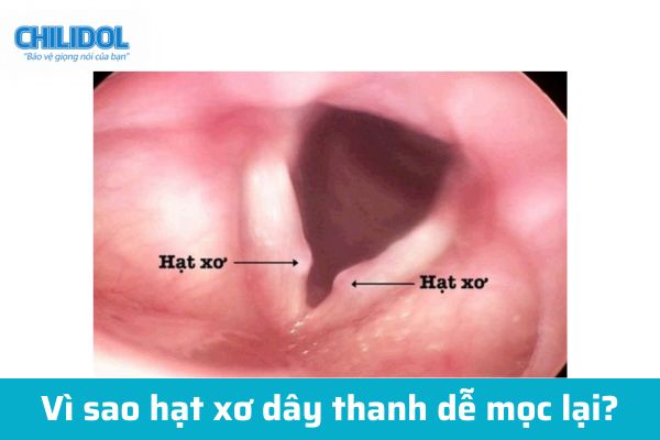 Vì sao hạt xơ dây thanh dễ mọc lại?